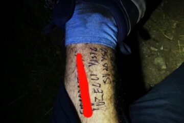 Turistul epuizat de efort a scris cu marker pe picior CNP-ul, numele și numărul mașinii, înmatriculată în Suceava