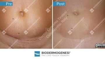 Rezultate BioDermaGenesi
