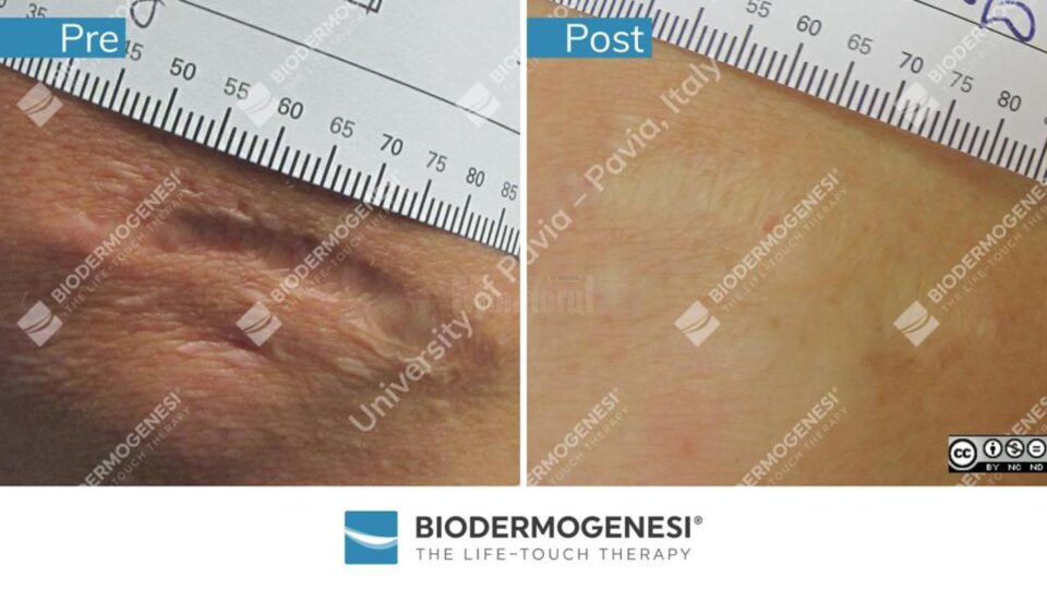Rezultate BioDermaGenesi