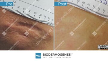 Rezultate BioDermaGenesi
