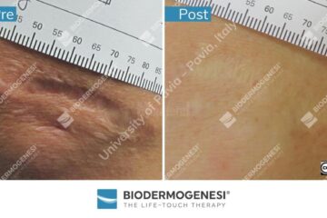 Rezultate BioDermaGenesi