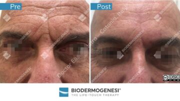 Rezultate BioDermaGenesi