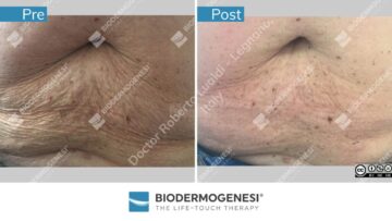Rezultate BioDermaGenesi
