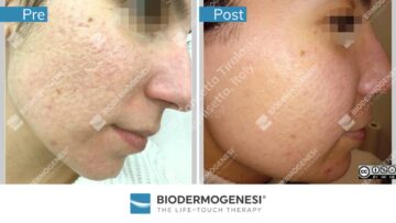 Rezultate BioDermaGenesi