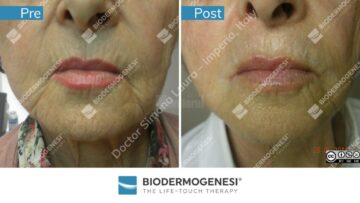 Rezultate BioDermaGenesi