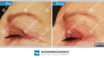Rezultate BioDermaGenesi