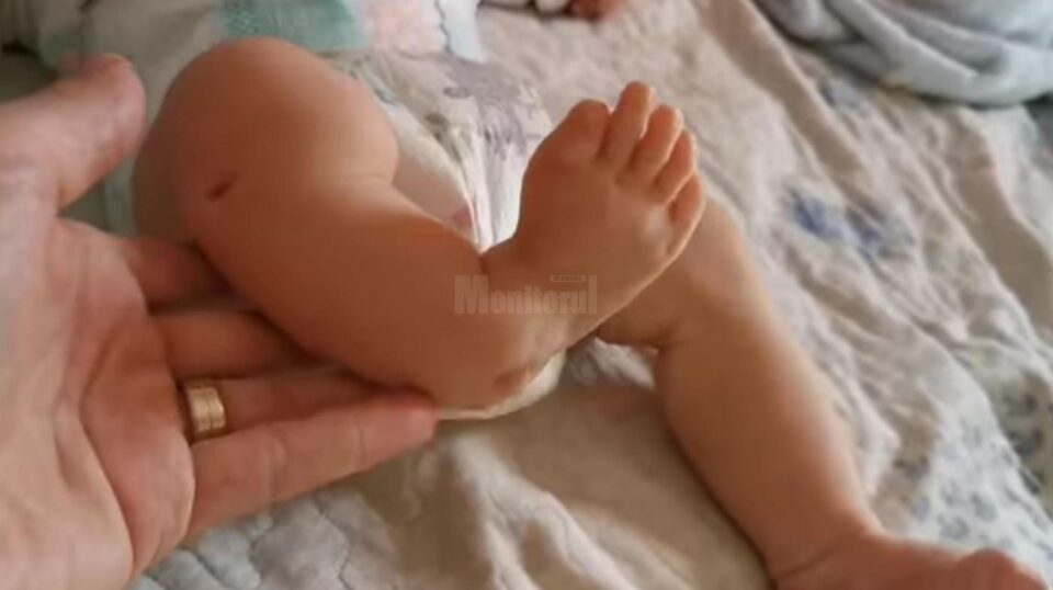 Un băiețel cu malformație congenitală la piciorul drept are nevoie de o operație care costă 40.000 de euro
