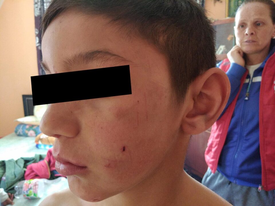 Copilul agresat de Daniel Dumitru Chirap