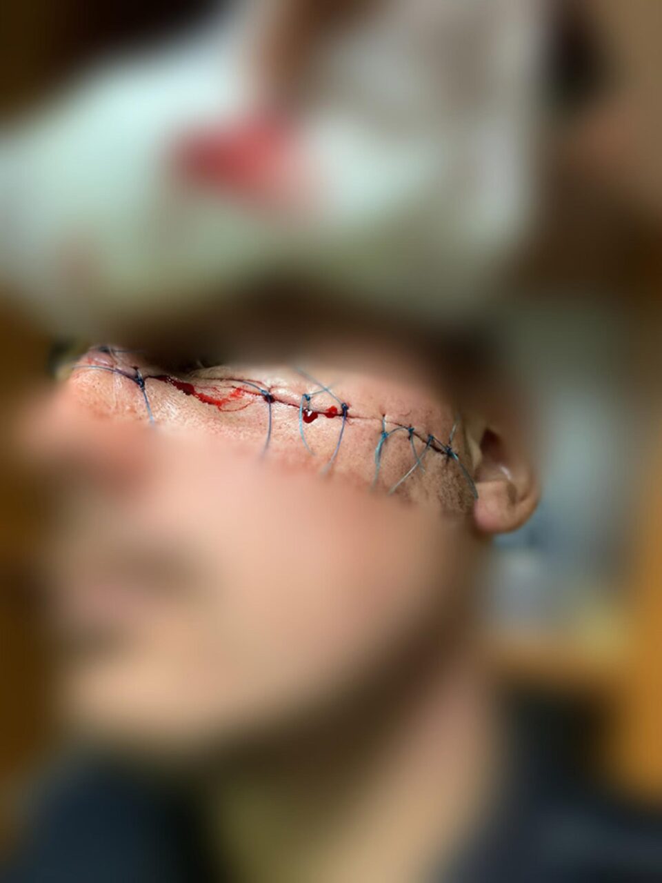 Tăietura provocată polițistului de individul care apoi și-a ucis bunicul