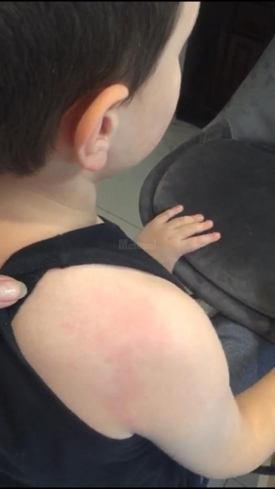 Familia ar fi apelat la un medic legist, care a constatat că băiatul are leziuni