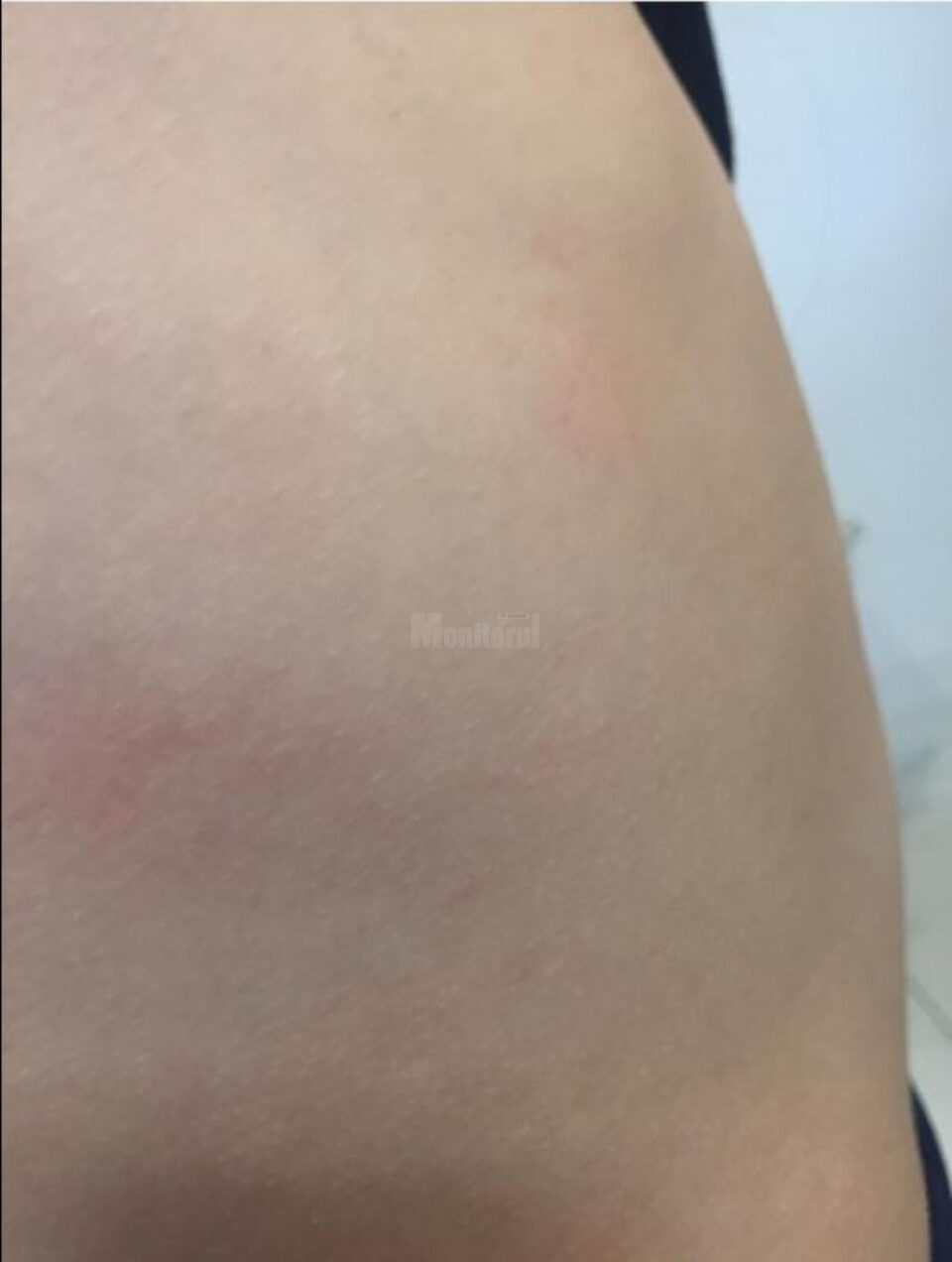 Familia ar fi apelat la un medic legist, care a constatat că băiatul are leziuni
