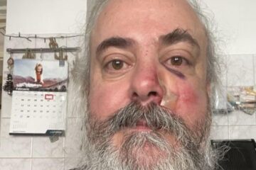 Florin ”Crivăț” Țibu după agresiunea din noaptea de vineri spre sâmbătă