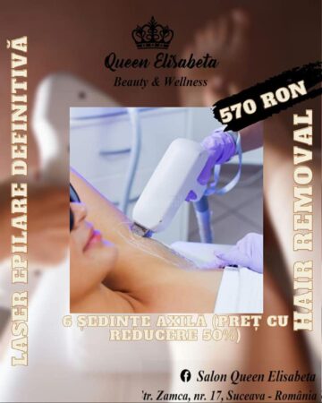 Oferta verii la epilarea definitivă cu laser, la Salonul Queen Elisabeta