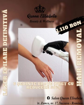 Oferta verii la epilarea definitivă cu laser, la Salonul Queen Elisabeta