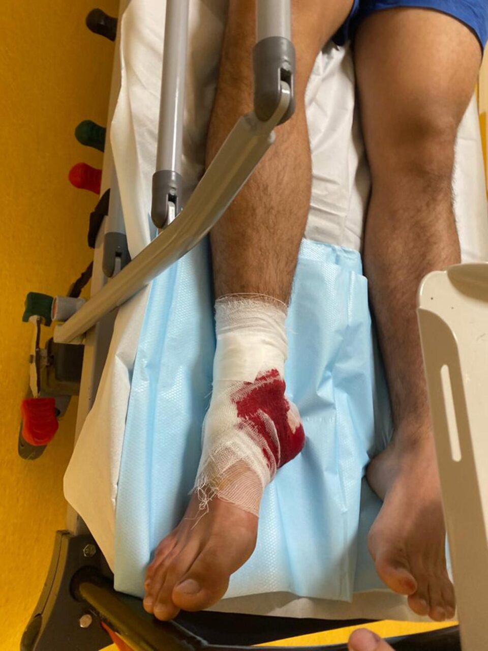 Încă un tânăr accidentat după ce a alunecat pe gresia udă la ștrandul de la Ițcani Încă un tânăr accidentat după ce a alunecat pe gresia udă la ștrandul de la Ițcani