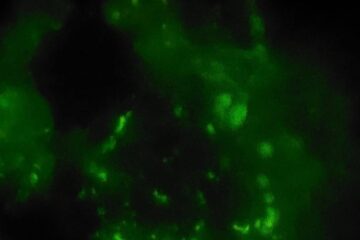 Imunoflorescența ce relevă depunere de C3 la nivelul capilarelor glomerulare