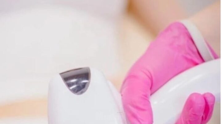 Epilare definitiva cu laser, la Queen Elisabeta