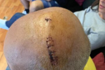 Bătrânul a fost operat de urgență pentru a-i fi salvată viața
