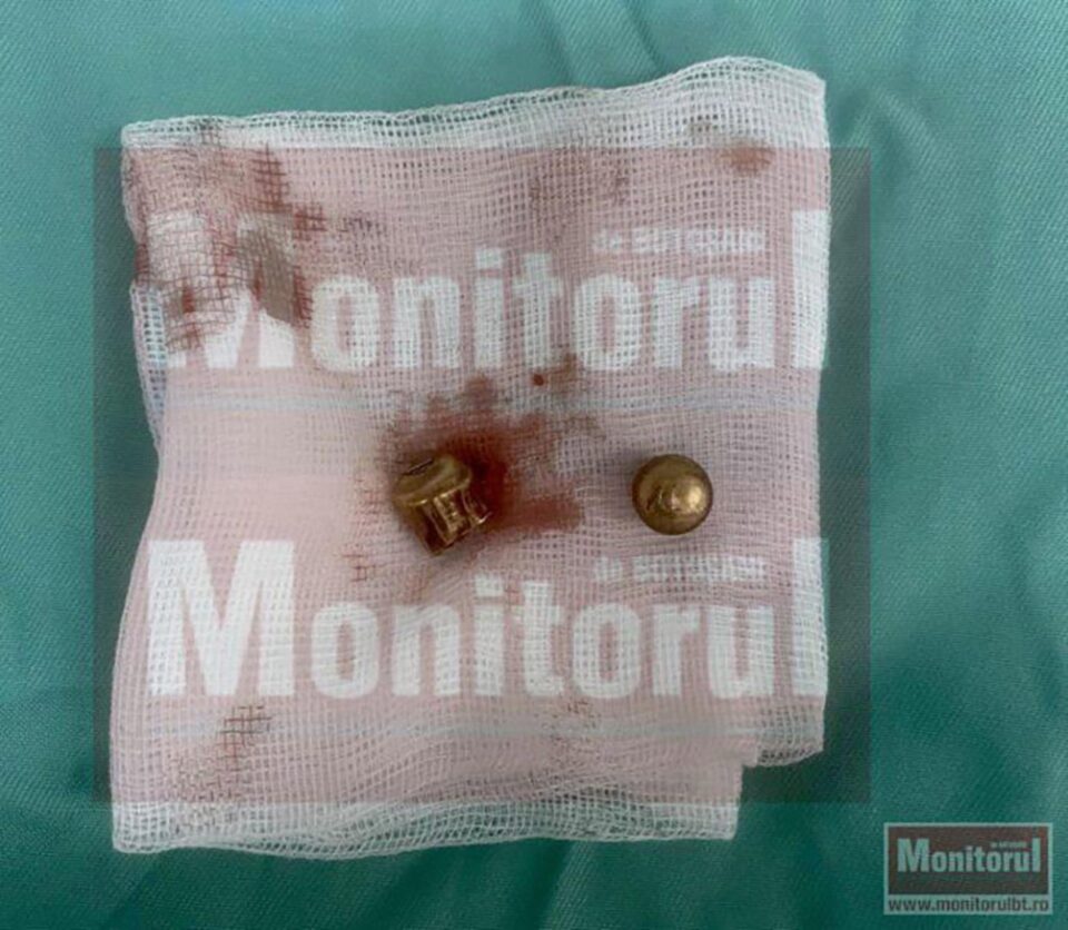 Fragmente extrase din abdomenul tânărului