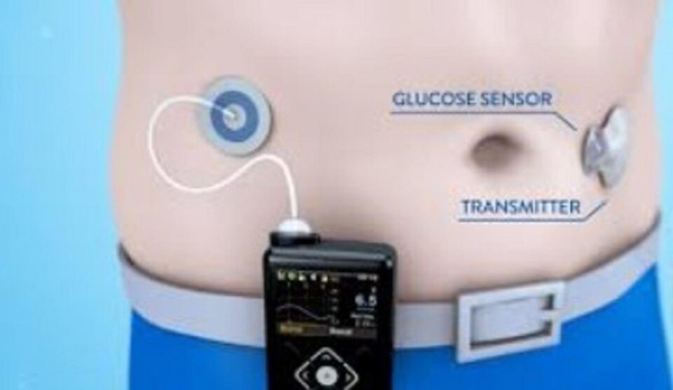 Unitatea medicală a fost inclusă în programul de tratament al diabetului prin pompe de insulină și senzori de glicemie Unitatea medicală a fost inclusă în programul de tratament al diabetului prin pompe de insulină și senzori de glicemie