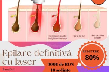 Salon Queen Elisabeta, preț imbatabil la epilarea definitivă cu laser: zece ședințe, full body, la 3.000 lei