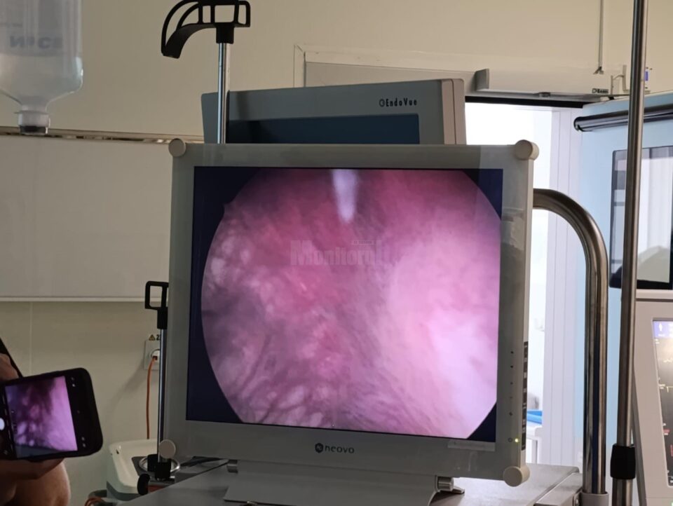 Fată de 18 ani, însărcinată, salvată printr-o intervenție chirurgicală extrem de dificilă la Spitalul Clinic Județean de Urgență Suceava Fată de 18 ani, însărcinată, salvată printr-o intervenție chirurgicală extrem de dificilă la Spitalul Clinic Județean de Urgență Suceava