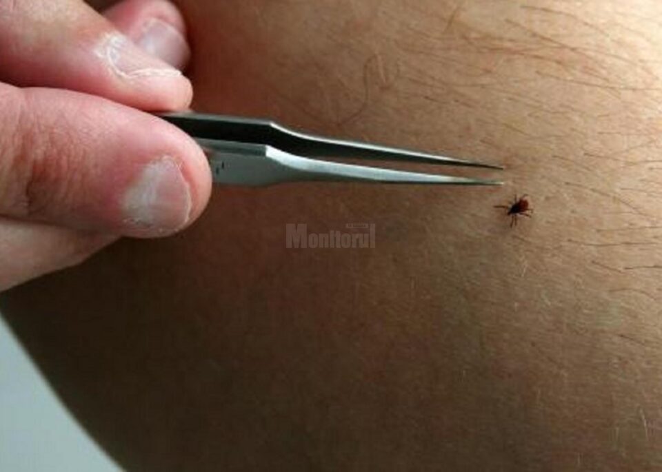 Aproape 400 de oameni mușcați de căpușe s-au prezentat la UPU Suceava în acest sezon