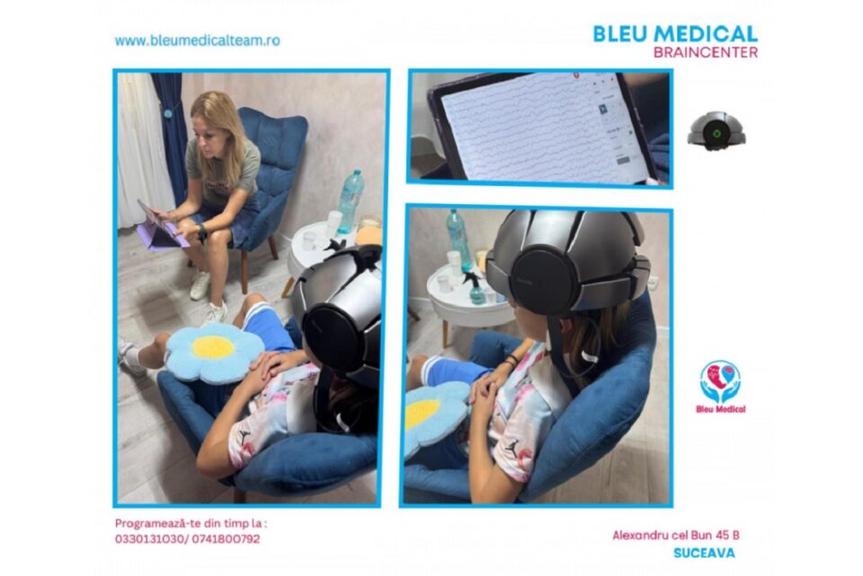 Brain mapping, serviciu căutat azi, disponibil la Bleu Medical - clinică de psihiatrie din Suceava. Sursă foto: bleumedical.ro