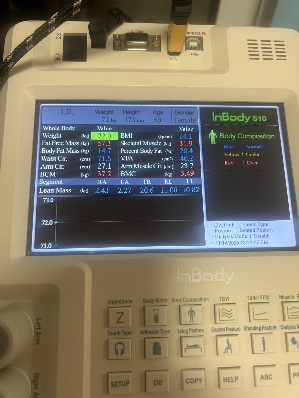 La testarea gratuită a glicemiei, oferită de Spitalul Clinic Suceava, 24 de suceveni au aflat că au diabet