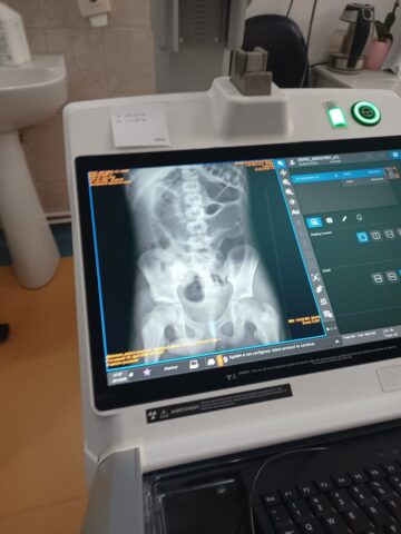 Pacienții spitalului din Suceava nu vor mai fi plimbați între clădiri pentru o radiografie. Consiliul Județean a achiziționat un aparat de radiologie mobil