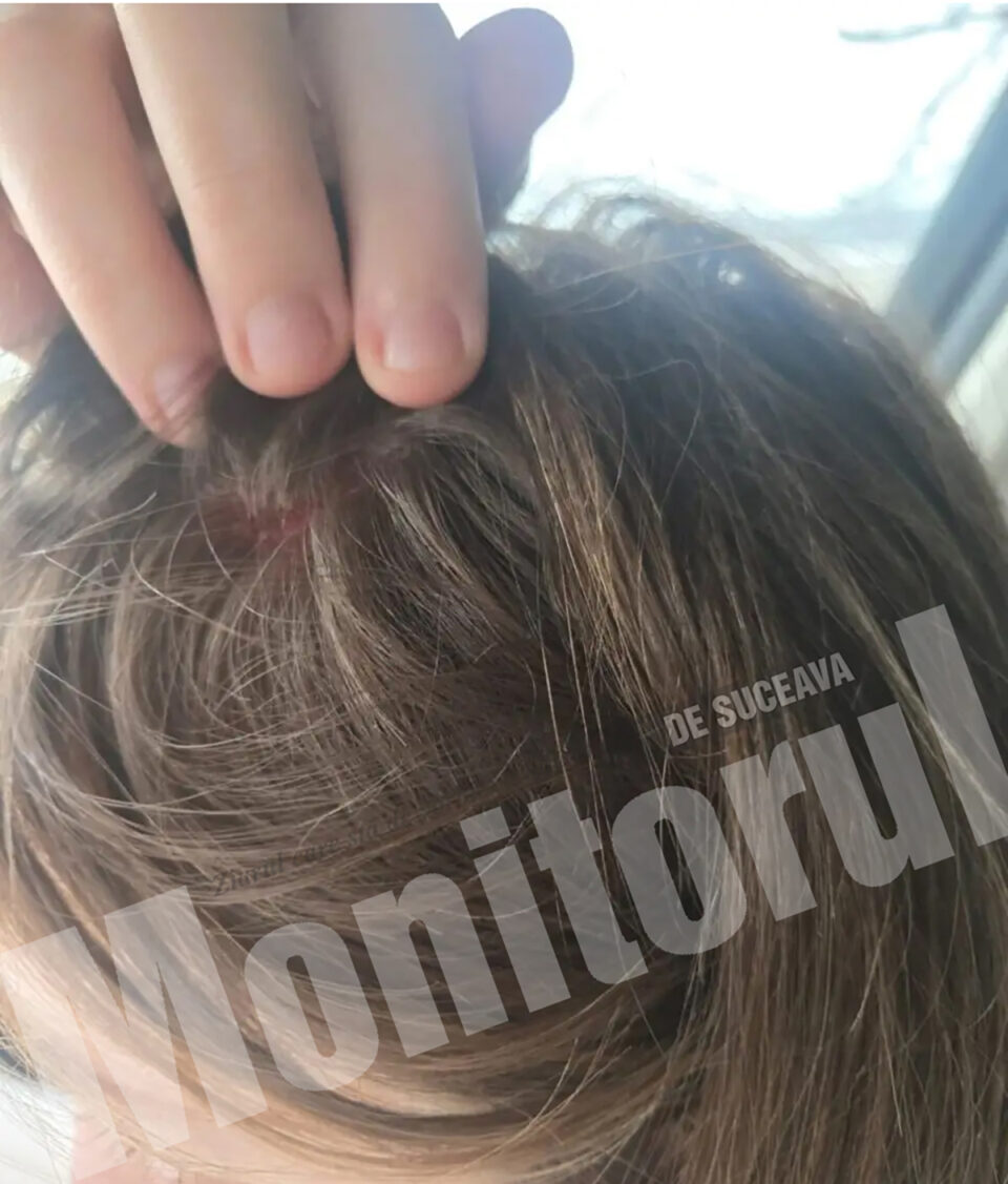 Avocatul mamei și fiicei care ar fi fost agresate de primarul Reziuc: „Vorbim despre două femei care au fost legate, lovite, sechestrate o noapte întreagă”