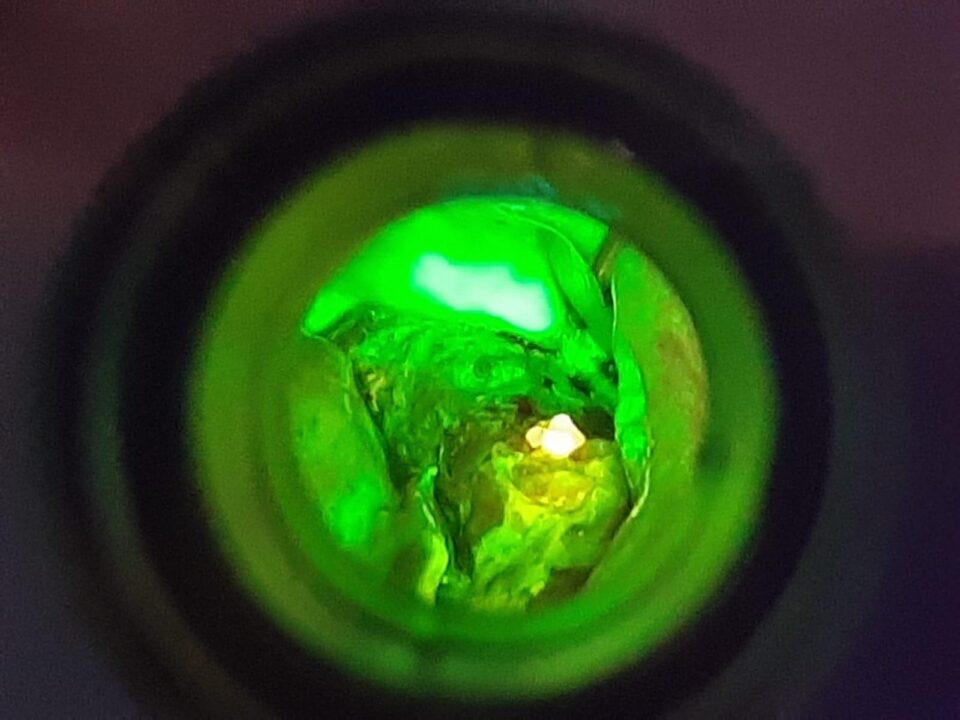 Testare gratuită pentru depistarea timpurie a cancerului oral, la Spitalul Clinic de Urgență Suceava