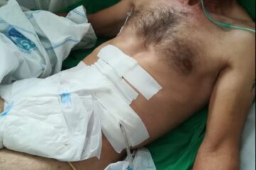 Cinci bătăuși, condamnați pentru o agresiune criminală de acum 8 ani, cu rupturi de organe și 11 coaste rupte. Agresorii nu au ajuns nici acum la pușcărie Cinci bătăuși, condamnați pentru o agresiune criminală de acum 8 ani, cu rupturi de organe și 11 coaste rupte. Agresorii nu au ajuns nici acum la pușcărie